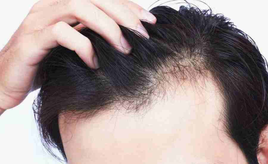 6 Remedies to Grow Hair Faster naturally