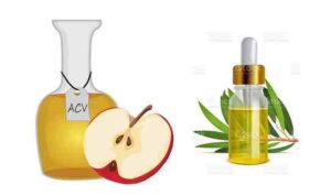 apple vinegar remove dandruff naturally