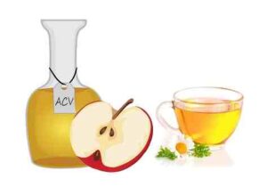 apple vinegar remove dandruff naturally